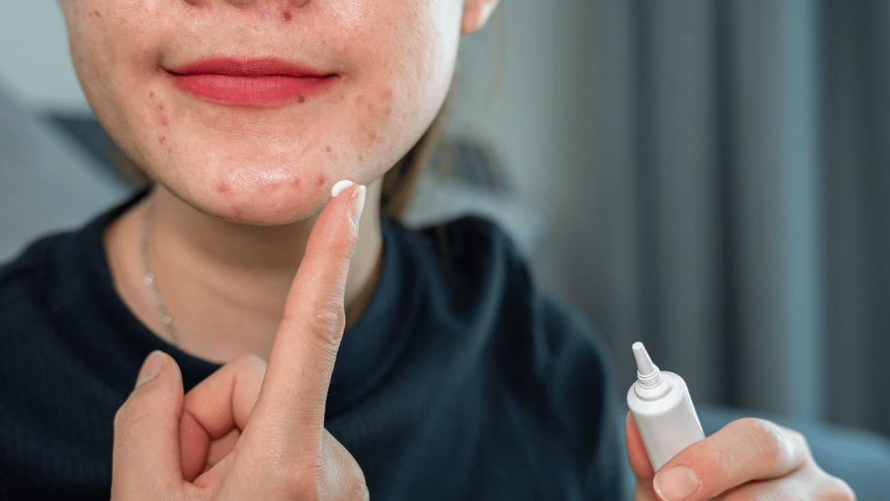 can you mix benzoyl peroxide with niacinamide